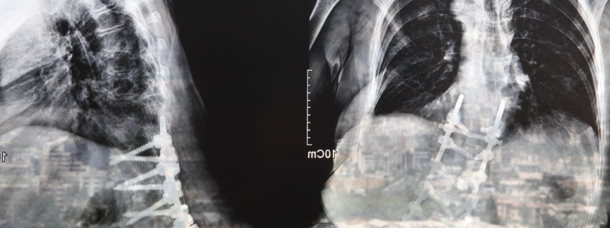 Radiograph of a Family