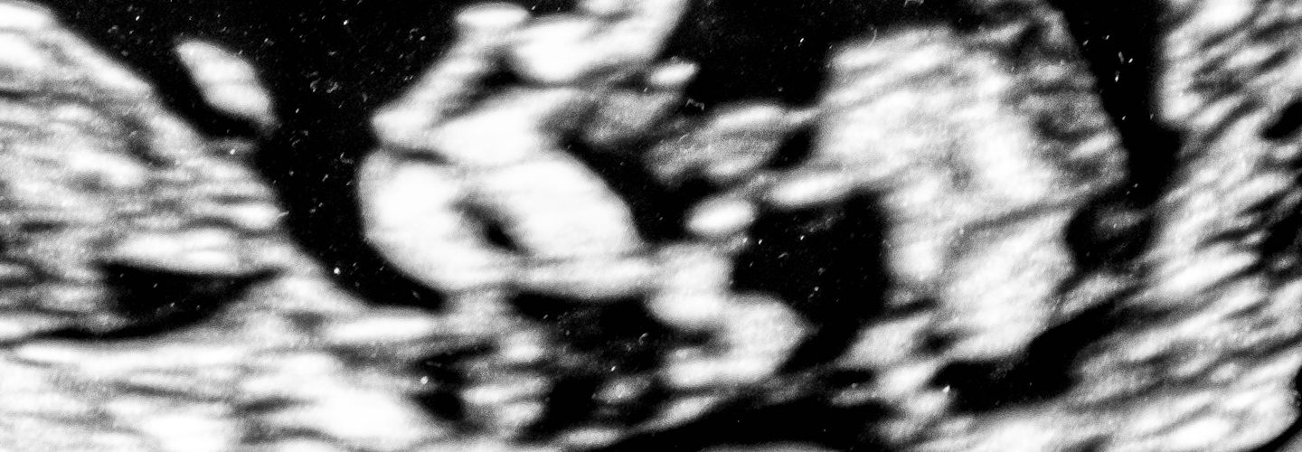 monolithic tenderness