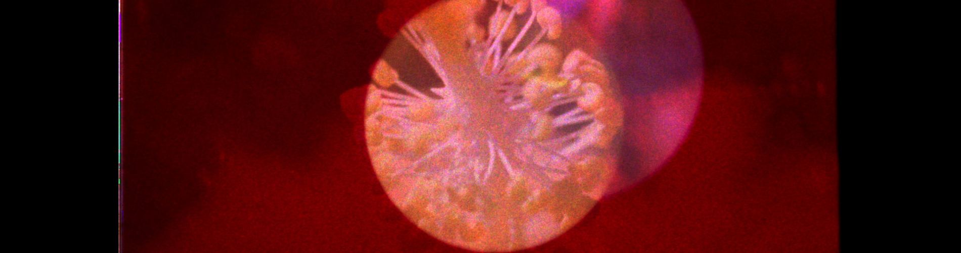 Irradiation