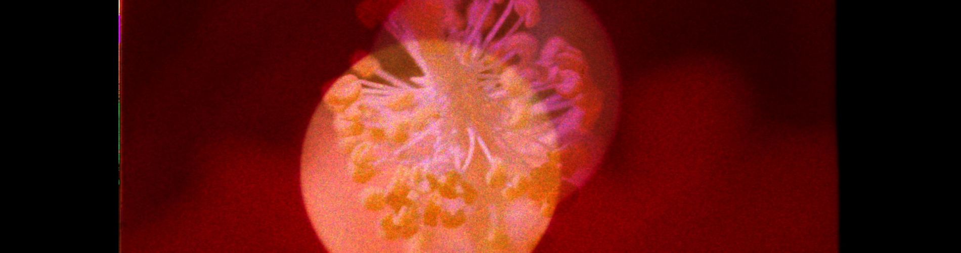 Irradiation