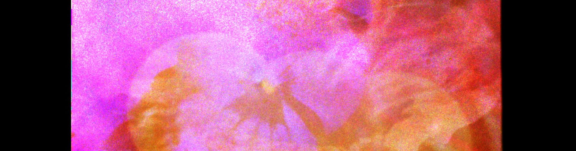 Irradiation