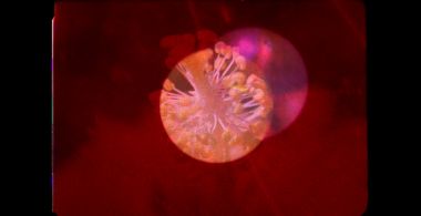 Irradiation